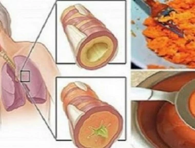 Αυτό είναι το σπιτικό σιρόπι που θεραπεύει τον βήχα- Δείτε πως να το φτιάξετε